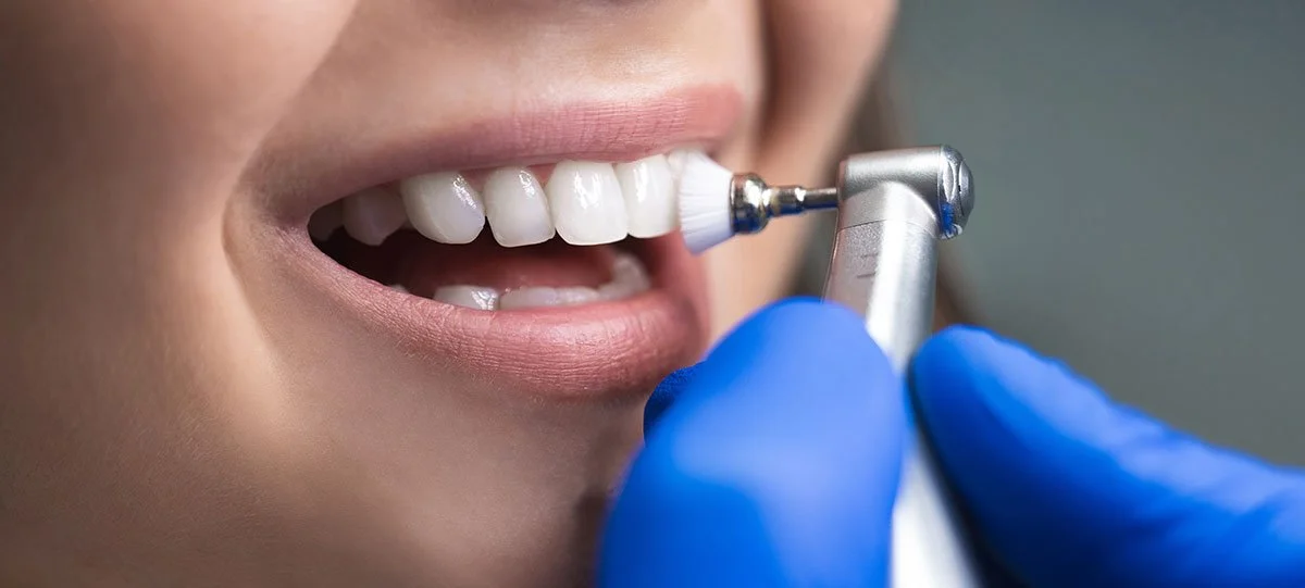 Teeth Cleaning Scaling