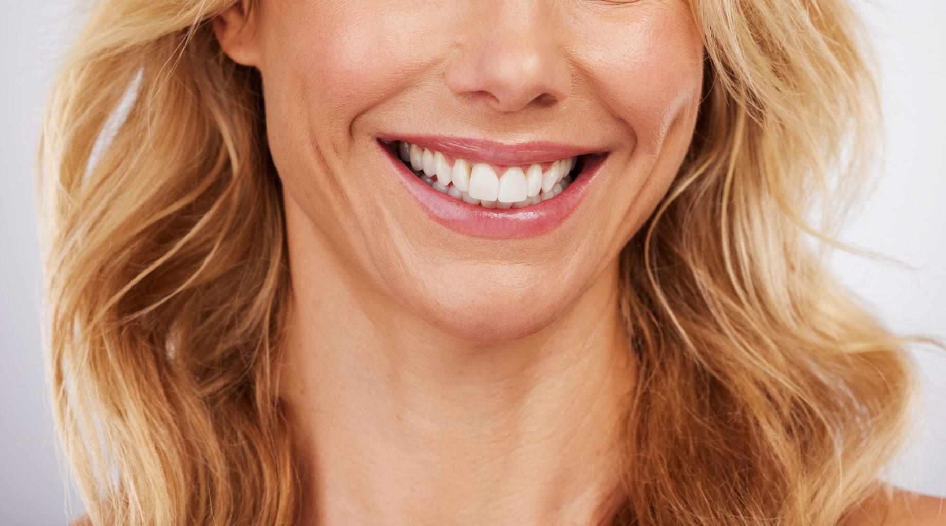 Teeth Whitening