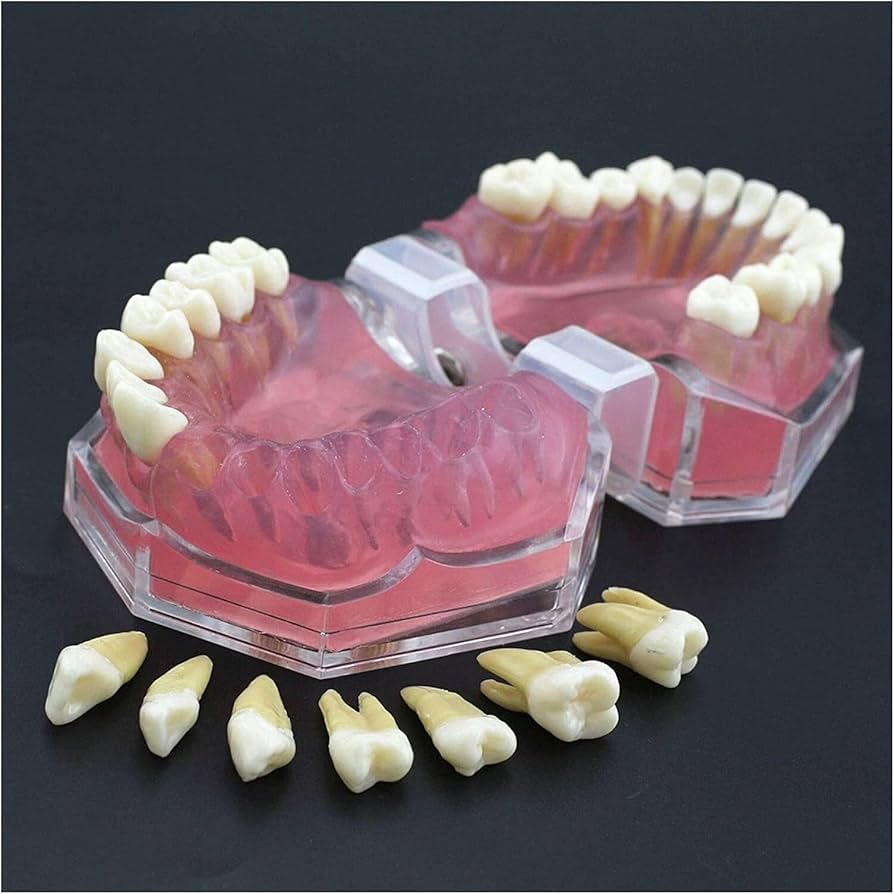 Tooth Extraction